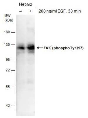 Western Blot: FAK [p Tyr397] Antibody [NBP3-12897]